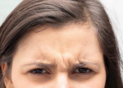 Frown lines on a woman's face