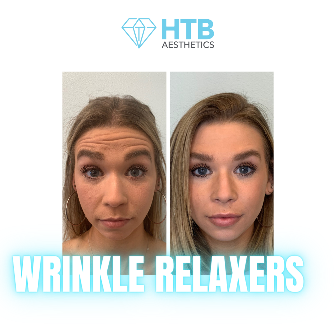 Wrinkle Relaxers